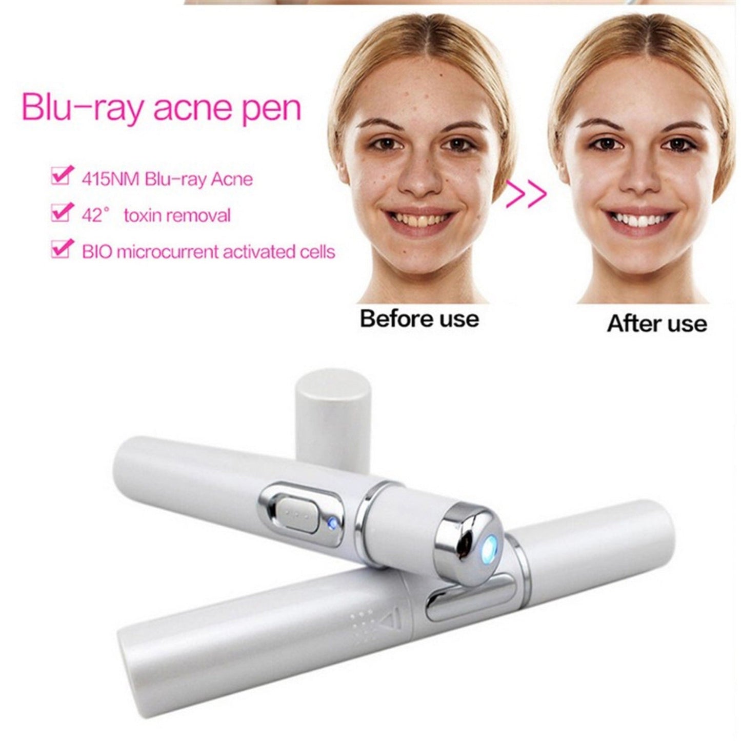 OKALIA BlueLight Pen – Stylo Lumière Bleue Anti-Acné & Anti-Rides